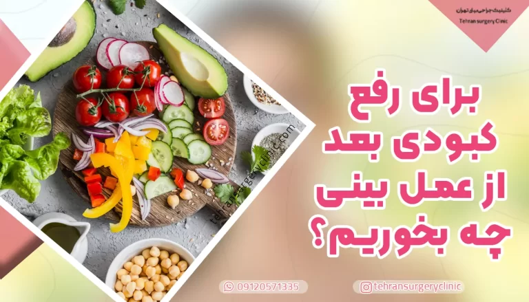 برای رفع کبودی بعد از عمل بینی چه بخوریم؟