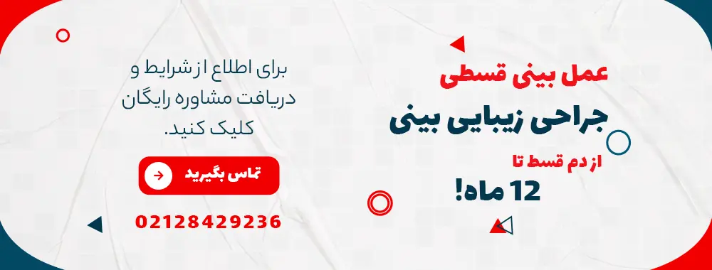 تماس جهت عمل بینی قسطی