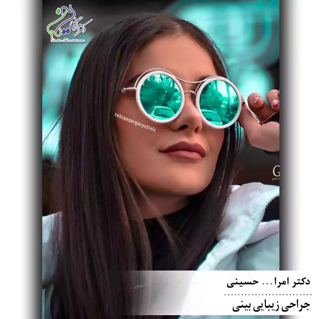 جراحی زیبایی بینی دکتر حسینی