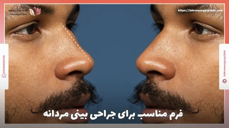 فرم مناسب برای جراحی بینی مردانه