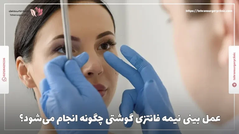عمل بینی نیمه فانتزی گوشتی چگونه انجام می‌شود؟