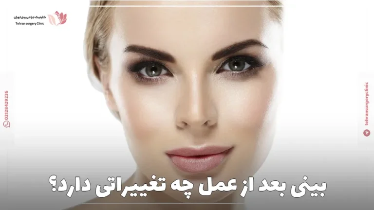 بینی بعد از عمل چه تغییراتی دارد؟
