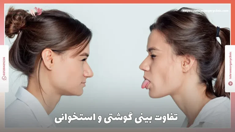 تفاوت بینی استخوانی و بینی گوشتی: بینی گوشتی بهتر است یا استخوانی