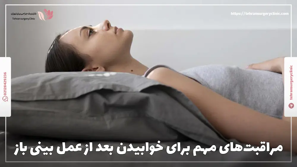 خانمی که عمل بینی باز انجام داده و مراقبت های بعد از عمل رو داره رعایت میکنه