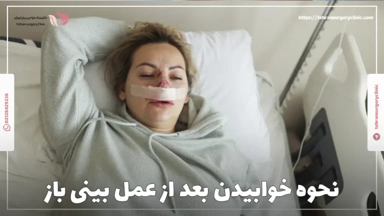 نحوه خوابیدن بعد از عمل بینی باز