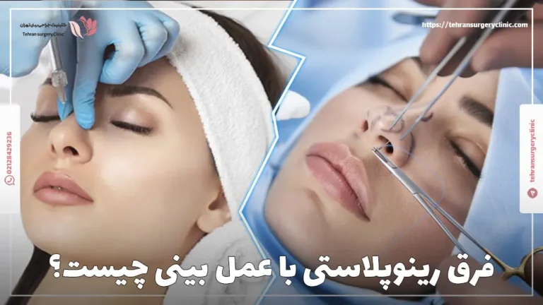 فرق رینوپلاستی با عمل بینی چیست؟ مزایا و کاندیدای رینوپلاستی نسبت به عمل بینی