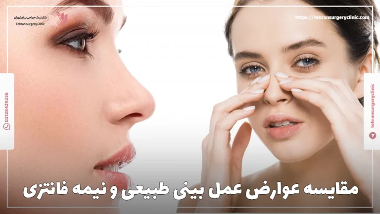 مقایسه عمل بینی طبیعی و نیمه فانتزی