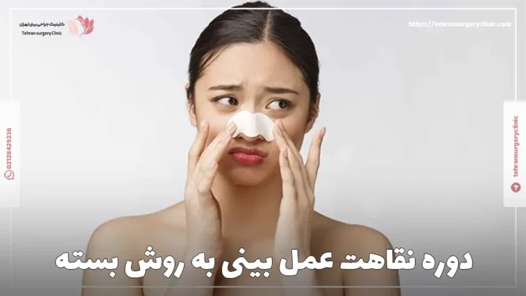 دوره نقاهت عمل بینی به روش بسته