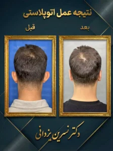عمل زیبایی گوش دکتر یزدانی