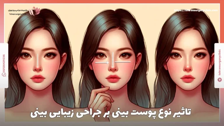 تاثیر نوع پوست بینی بر جراحی زیبایی بینی