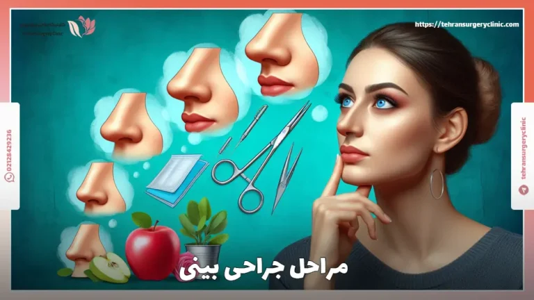 مراحل جراحی بینی | راهنمای پله به پله مراحل عمل زیبایی بینی