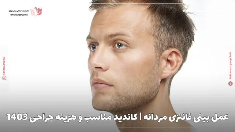 عمل بینی فانتزی مردانه | کاندید مناسب و هزینه جراحی 1404