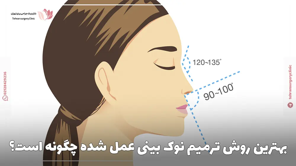 بهترین روش ترمیم نوک بینی عمل شده چگونه است؟