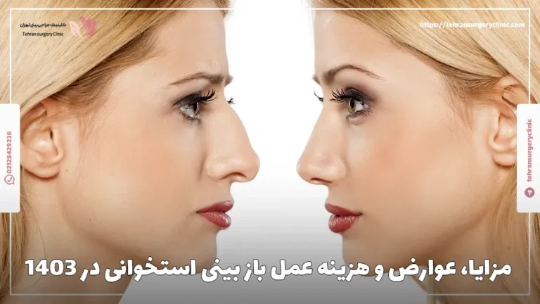 مزایا، عوارض و هزینه عمل باز بینی استخوانی در 1404
