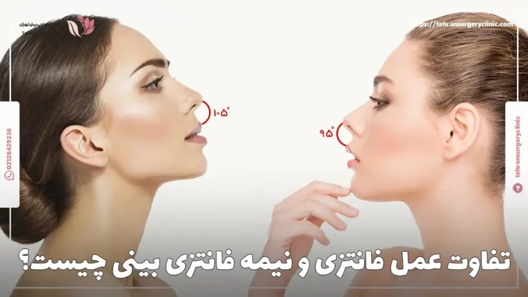 تفاوت عمل فانتزی و نیمه فانتزی بینی چیست؟