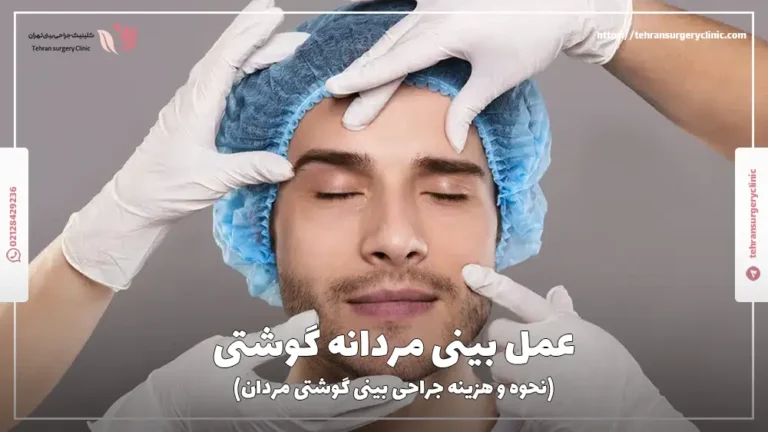 عمل بینی مردانه گوشتی | نحوه و هزینه جراحی بینی گوشتی مردان