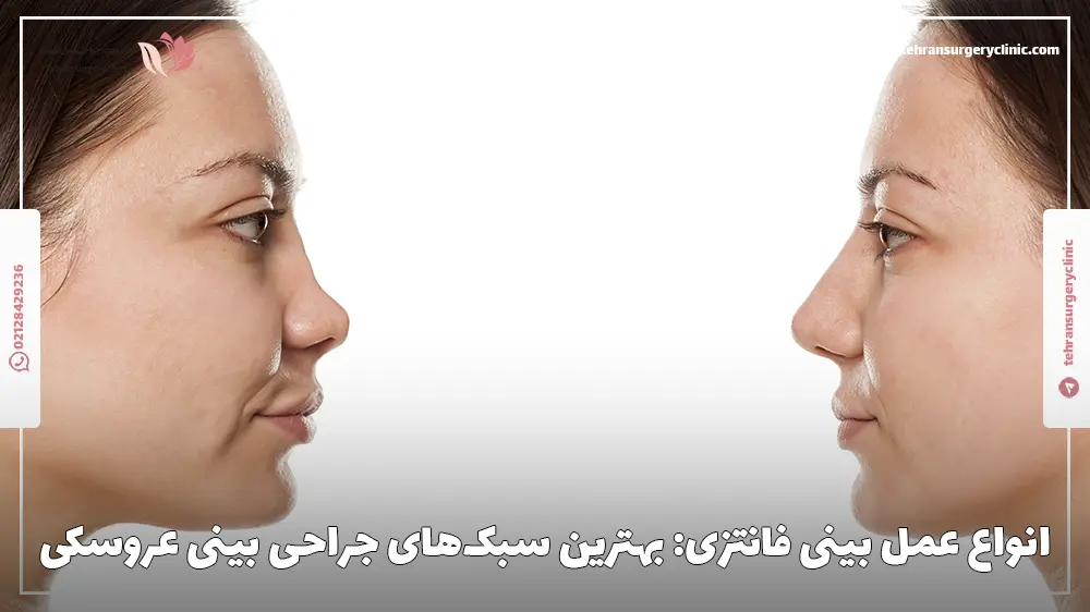 2 خانم جوان که هرکدام دارای یک مدل خاص از انواع عمل بینی فانتزی هستند.