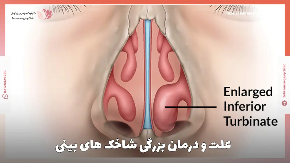 یک عکس انیمیشنی از بزرگی شاخک های بینی