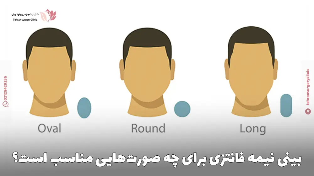 بینی نیمه فانتزی برای چه کسانی مناسب‌تر است؟