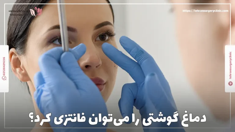 عمل بینی فانتزی گوشتی | دماغ گوشتی را می‌توان فانتزی کرد؟