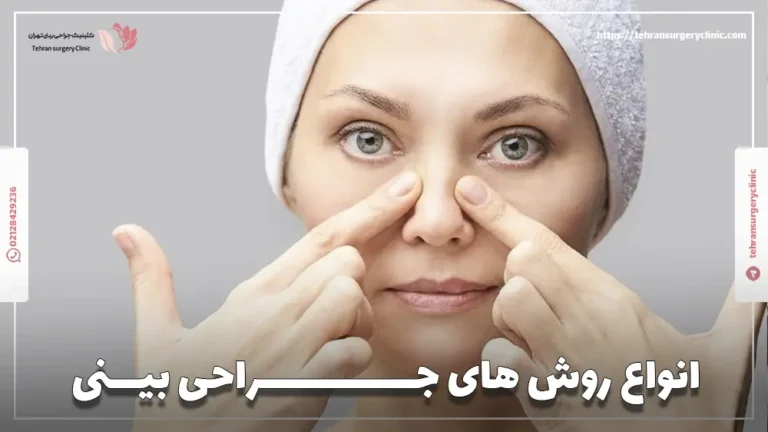 انواع روش های جراحی بینی