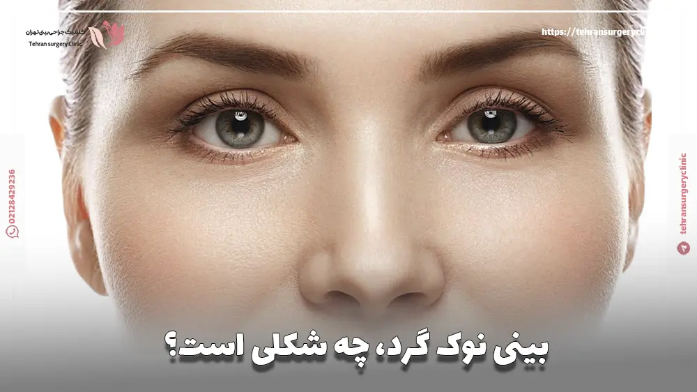 بینی نوک گرد، چه شکلی است؟
