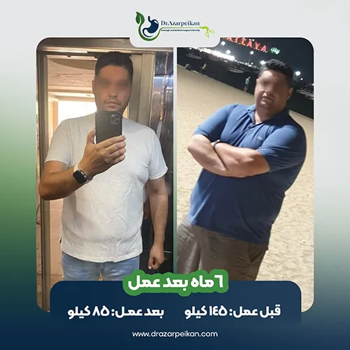 نتیجه عمل اسلیو دکتر آذرپیکان3