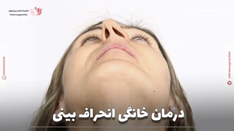 درمان خانگی انحراف بینی: 4 روش درمان انحراف دماغ در خانه