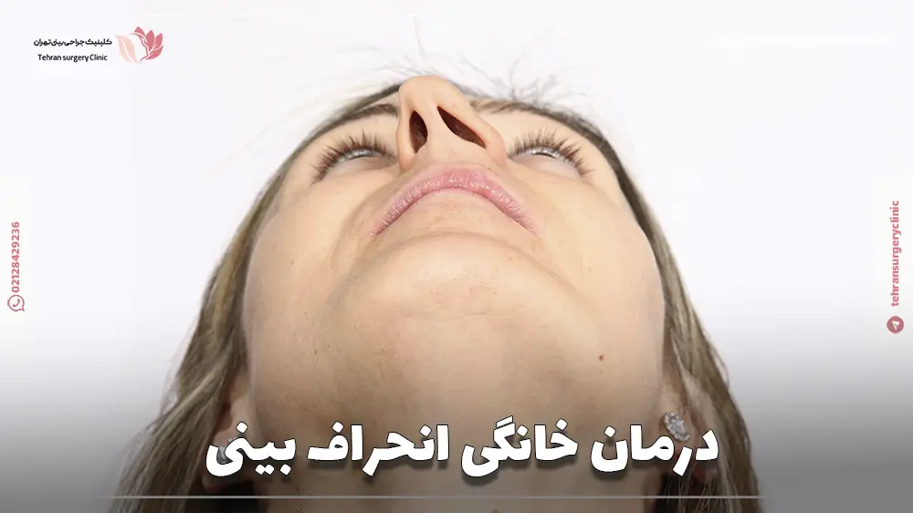 خانم جوانی که دچار انحراف سپتوم میباشد و بدنبال درمان خانگی انحراف بینی است.