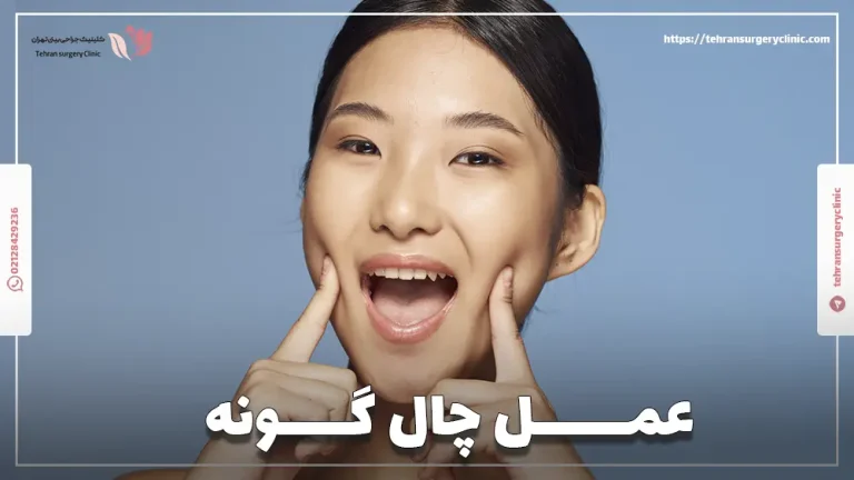 عمل چال گونه | مزایا، عکس و هزینه عمل چال گونه