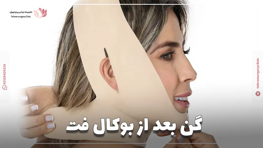 گن بعد از بوکال فت