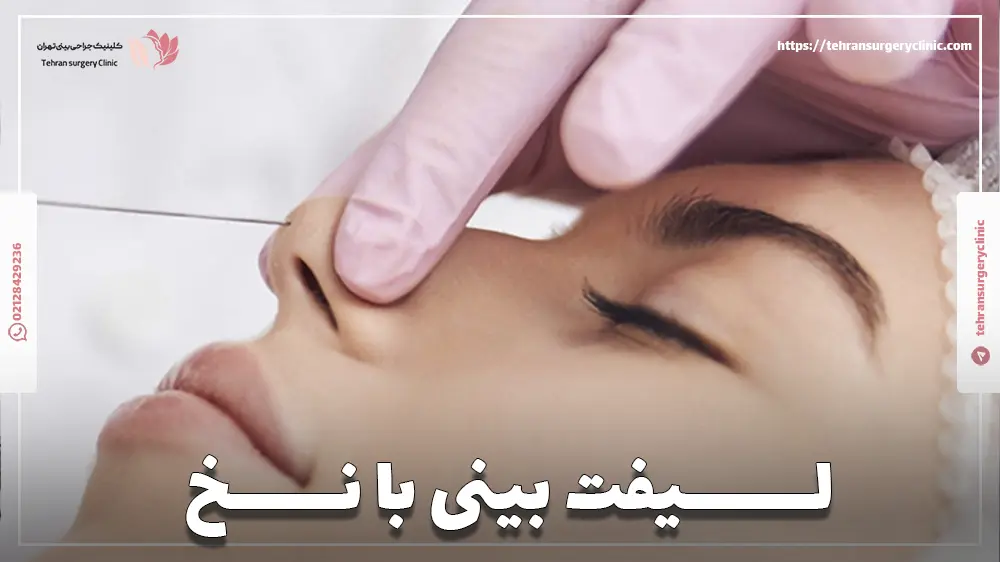 لیفت بینی با نخ