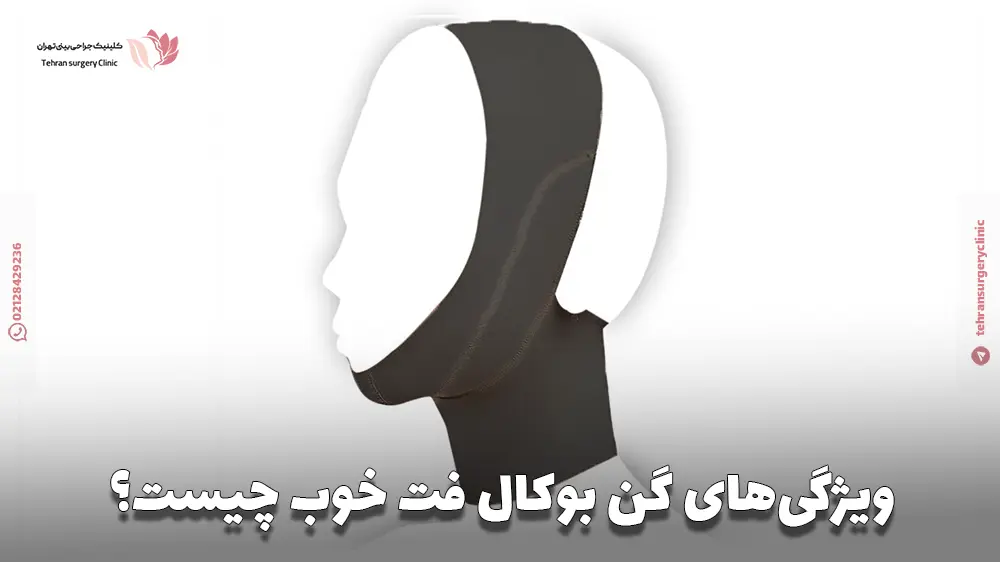 ویژگیهای گن بوکال فت خوب چیست؟