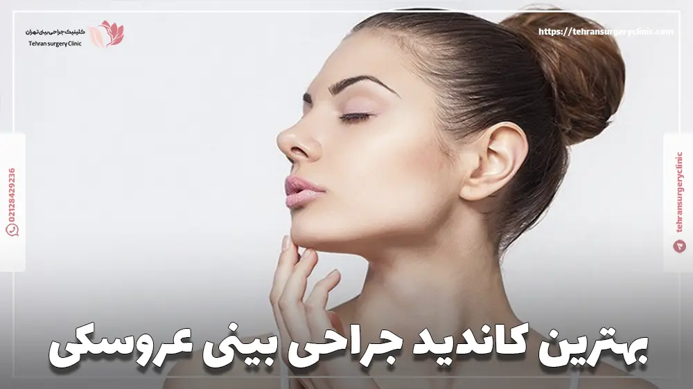 بینی عروسکی به چه صورتی میاد؟