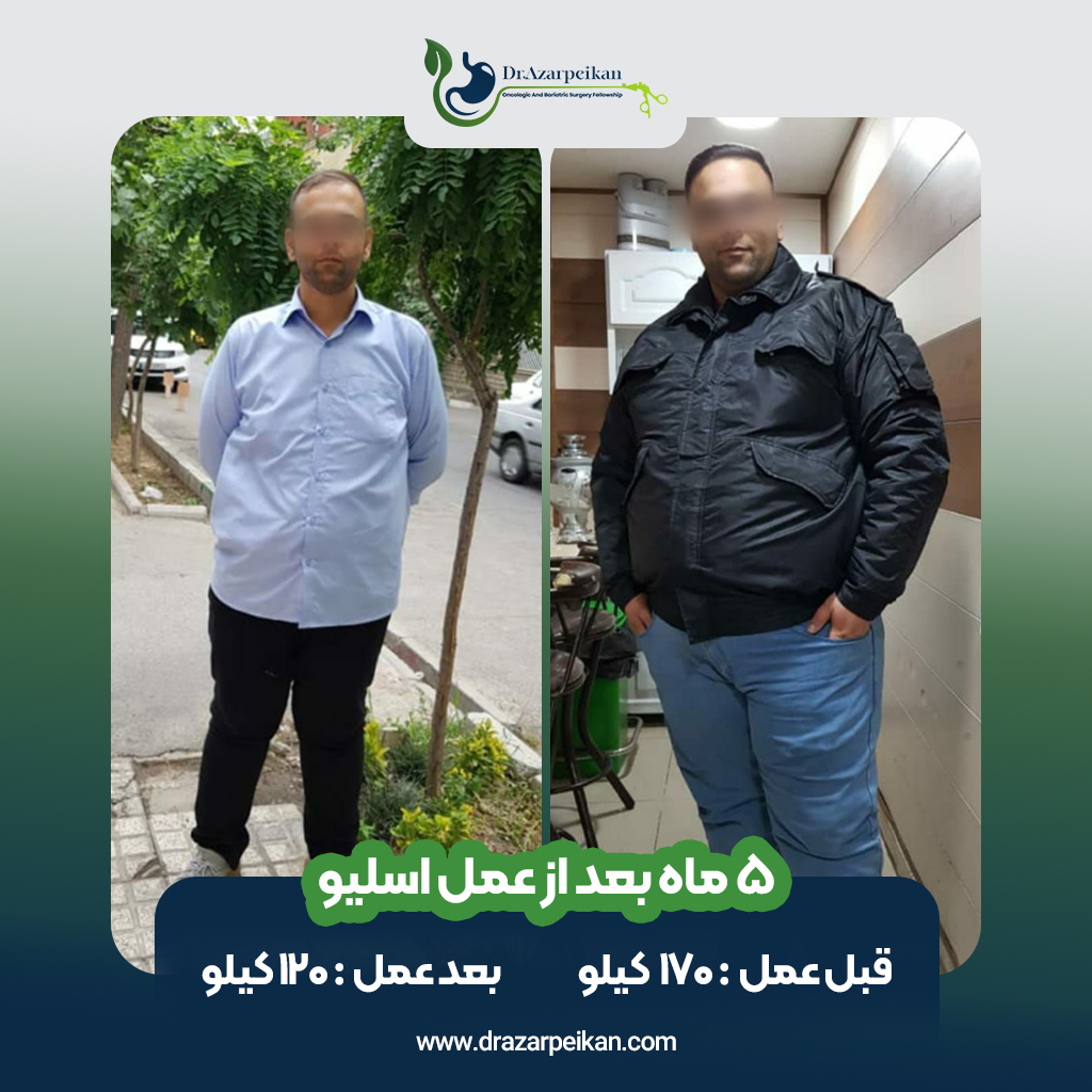 نتیجه عمل اسلیو دکتر آذرپیکان5