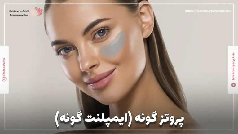 پروتز گونه (ایمپلنت گونه): مزایا، معایب و انواع و هزینه کاشت گونه