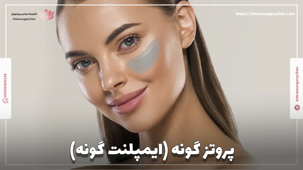 پروتز گونه