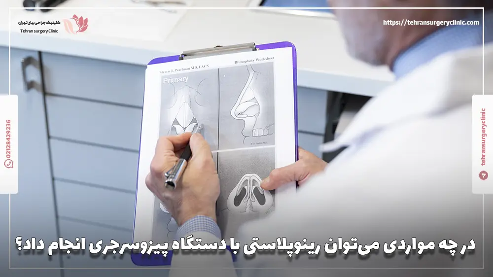 در چه مواردی میتوان رینوپلاستی با دستگاه پیزوسرجری انجام داد؟