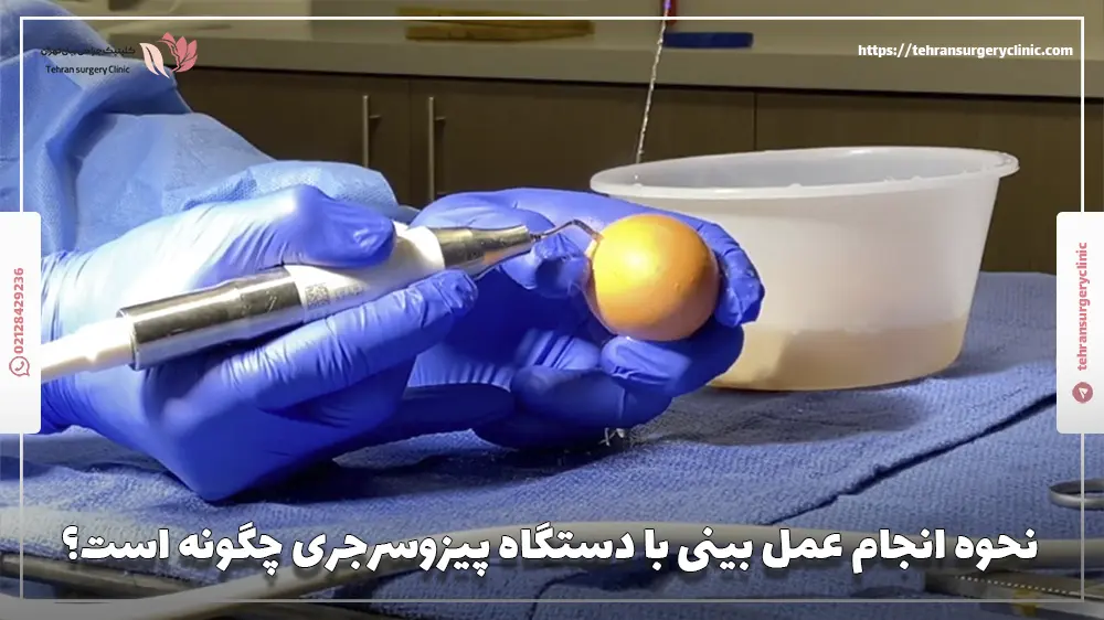 نحوه انجام عمل بینی با دستگاه پیزوسرجری چگونه است؟