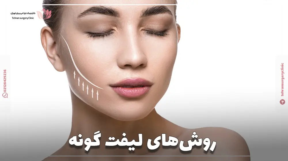 روشهای لیفت گونه