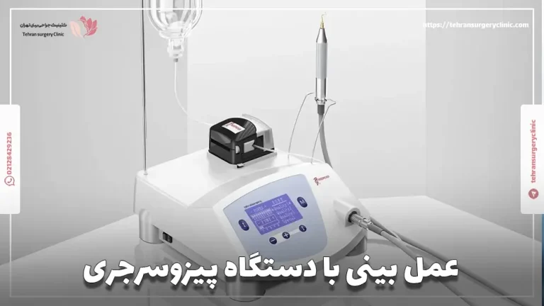 عمل بینی با دستگاه پیزوسرجری: مزایا، فیلم و هزینه