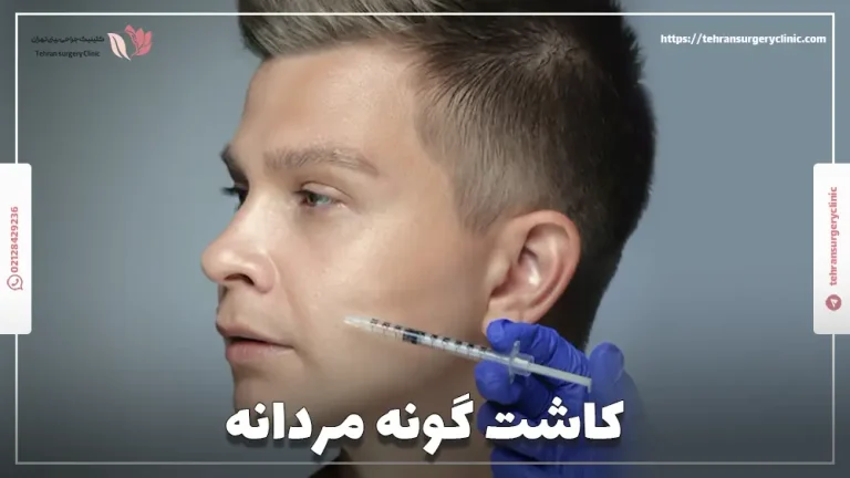کاشت گونه مردانه | عمل ایمپلنت گونه برای مردان