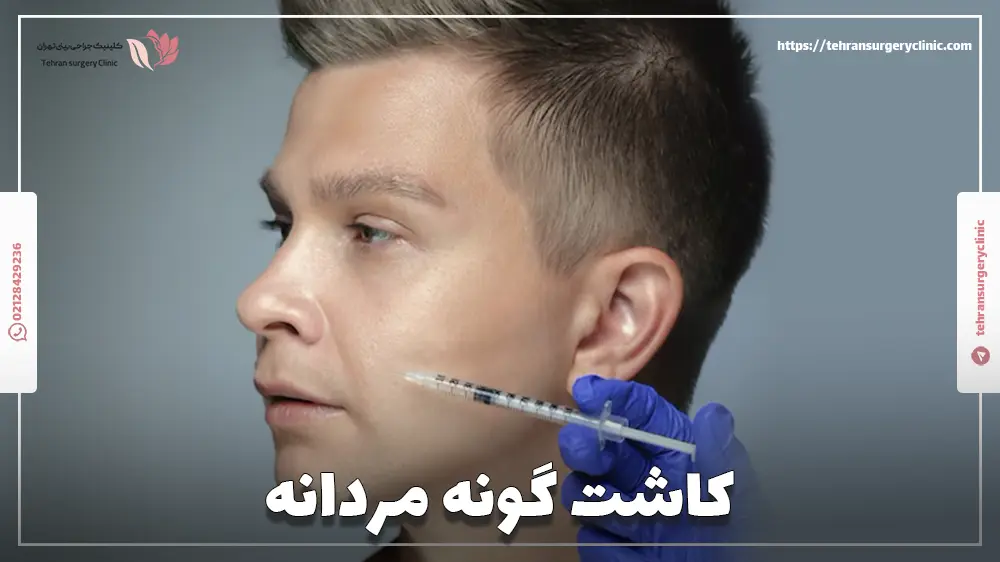 کاشت گونه مردانه