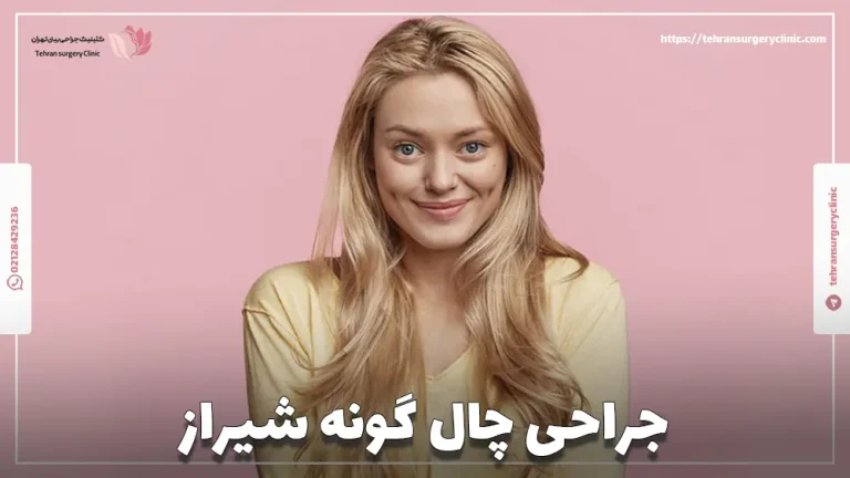 جراحی چال گونه شیراز | دکتر جراح چال گونه در شیراز
