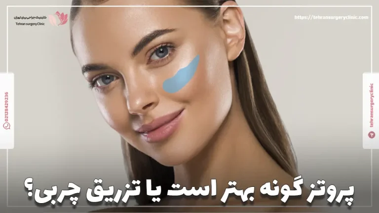 پروتز گونه بهتر است یا تزریق چربی؟ مقایسه جامع ایمپلنت گونه با چربی
