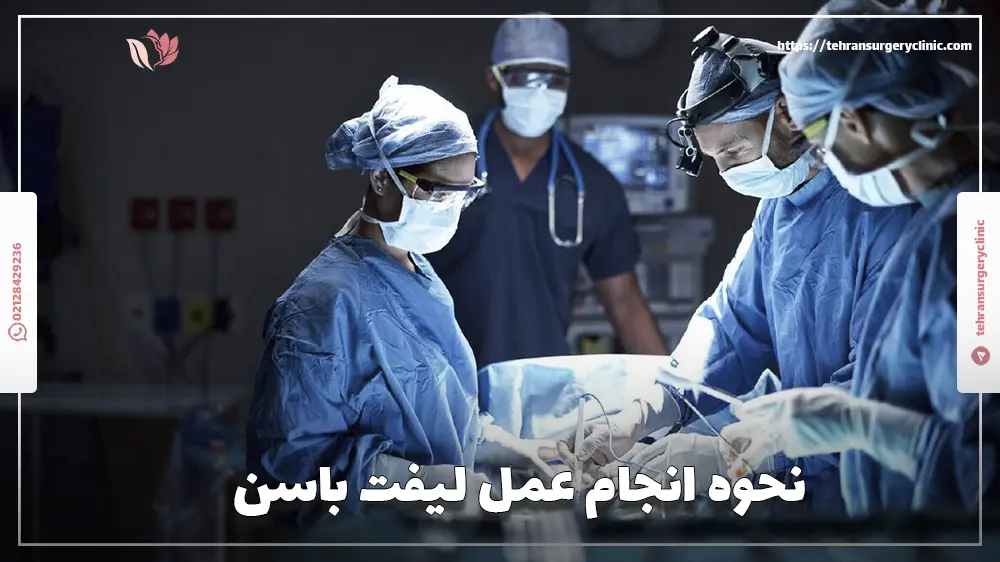 نحوه انجام عمل لیفت باسن