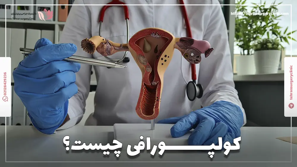 کولپورافی چیست؟