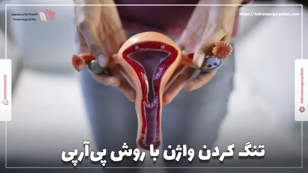تنگ کردن واژن با پی آر پی (PRP)