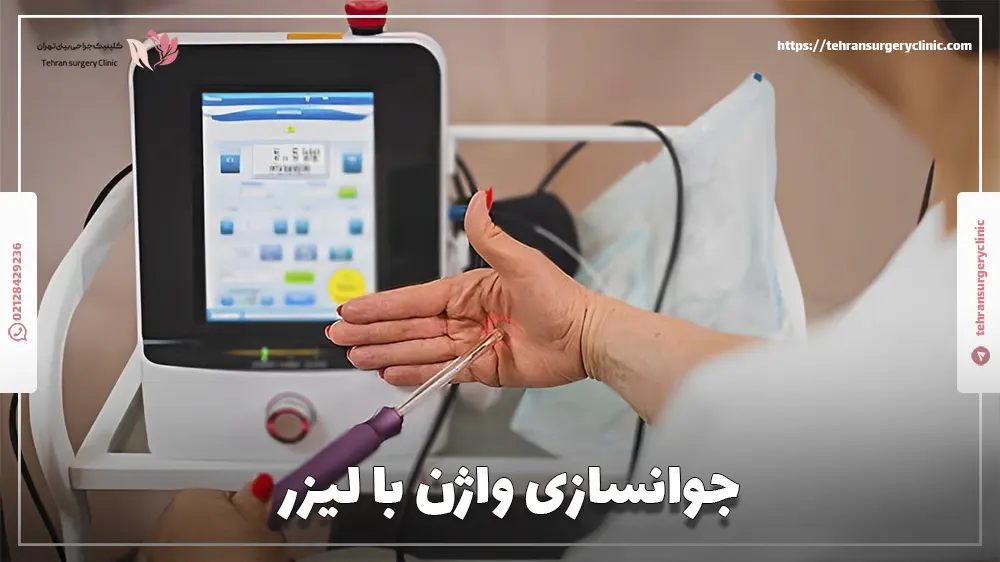 جوانسازی واژن با لیزر