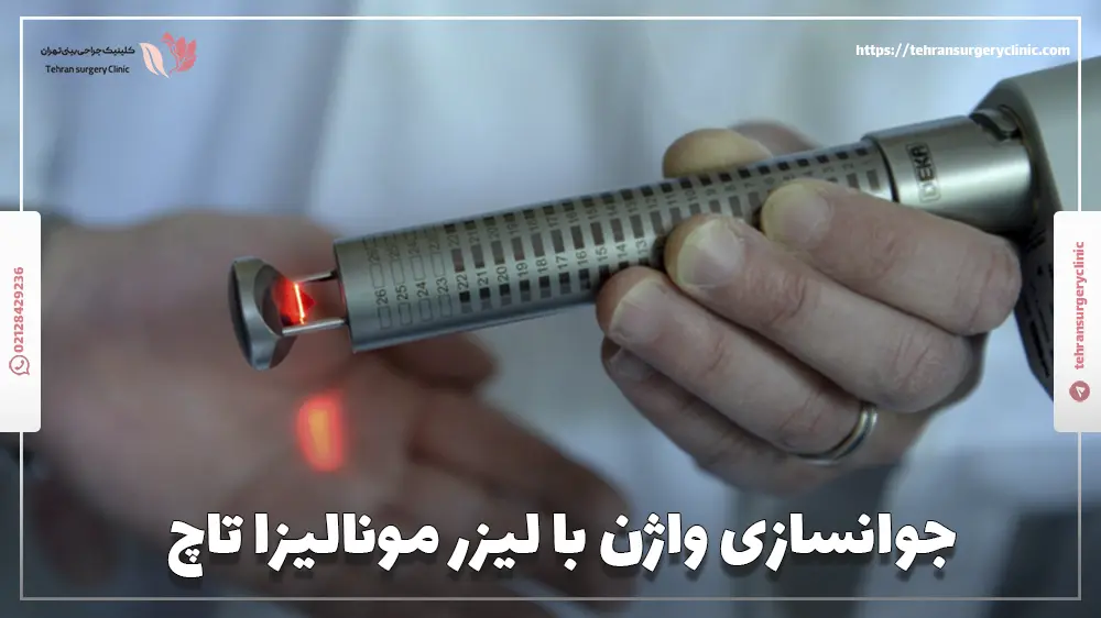 جوانسازی واژن با لیزر مونالیزا تاچ